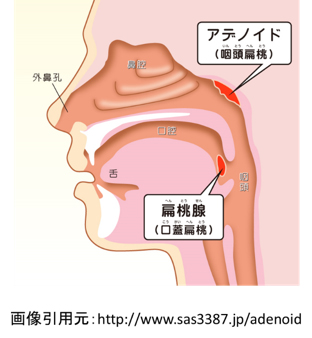 竹村耳鼻咽喉科クリニック 大阪府茨木市 鼻の病気